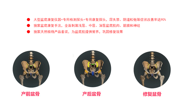 打噴嚏就漏尿，你的盆底肌修復好了嗎？