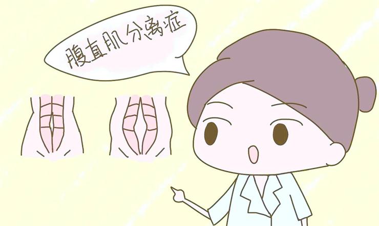 腹直肌分離，產后康復治療儀幫您