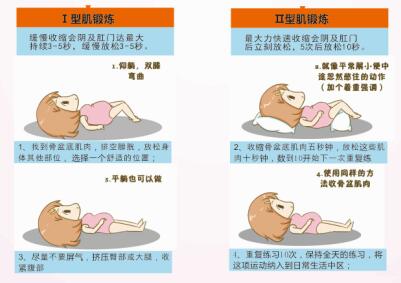 產后盆底肌修復治療設備，還以為剖腹產不用做盆底康復嗎？