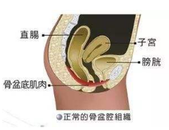 產后盆底肌怎么修復？你得做好盆底功能檢測