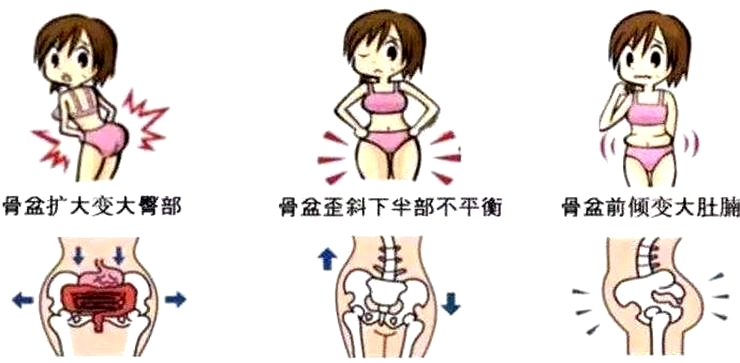 盆底康復治療怎么做，盆底治療儀是關鍵點
