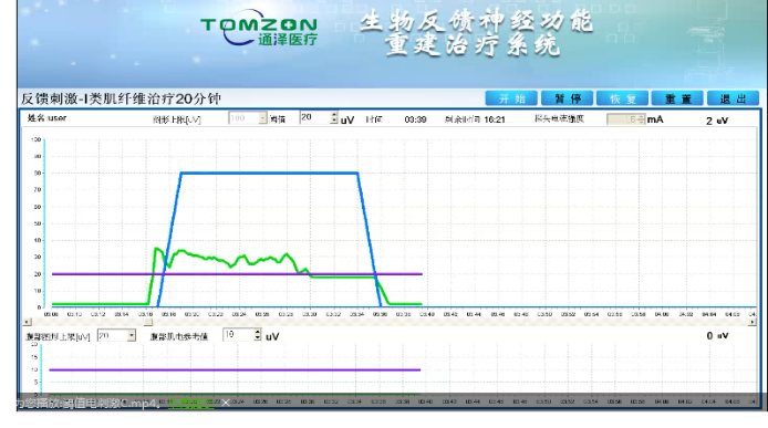 盆底康復治療怎么做？盆底康復治療肌電生物反饋治療儀的機理是什么？