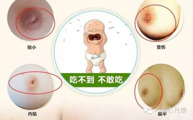 產后恢復為什么需要催乳儀器？