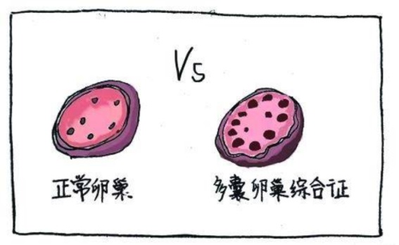 盆底肌康復治療怎么做，盆底肌修復十大常見問題（下）