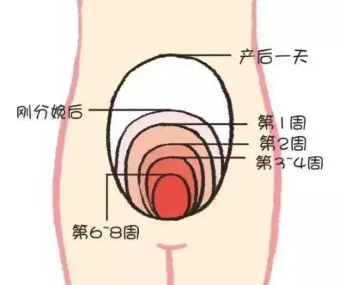 產后康復，什么叫子宮復舊不良？