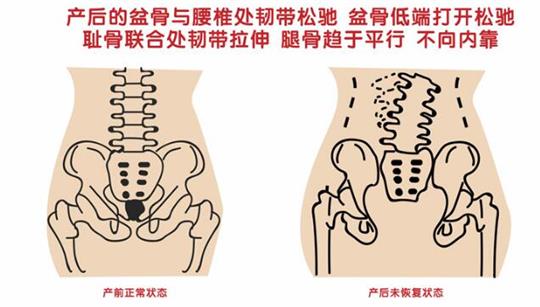 自從知道產后康復治療儀后，再也不怕腹直肌修復了