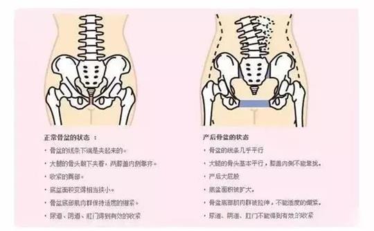 產后修復治療儀器對于腹直肌修復有效果嗎？