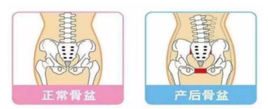別大意！進行產后修復項目，要選擇專業的產后修復中心