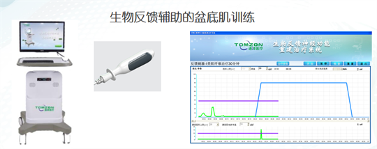 產后修復|盆底肌肉功能電刺激有什么作用？生物反饋呢？