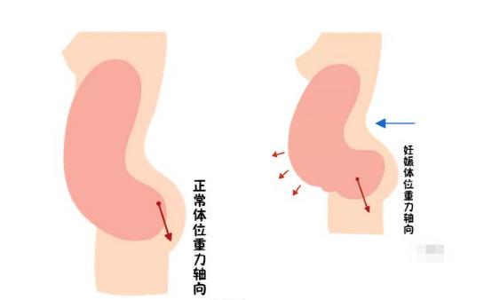 盆底恢復是否可以使用儀器？