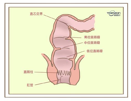 盆底康復治療儀對產后便秘有哪些幫助？