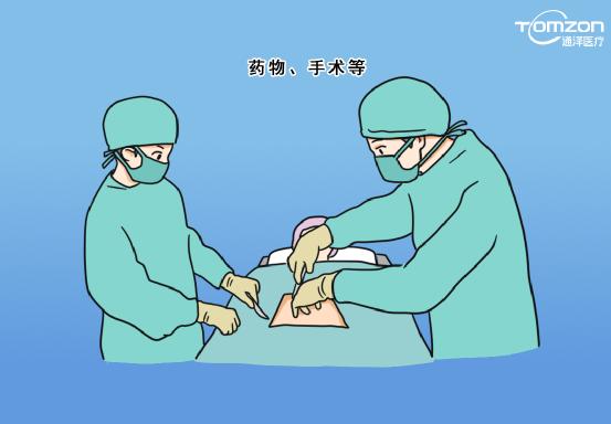 盆底治療儀應該什么時候使用？
