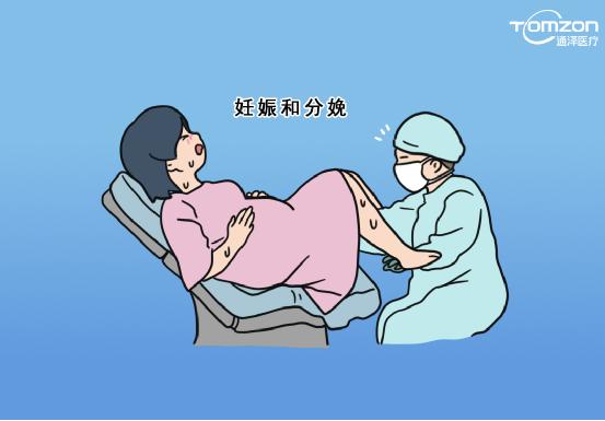 盆底康復治療儀是否可以促進盆底肌肉康復？