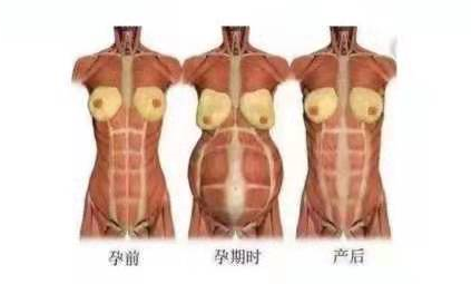 產后康復治療